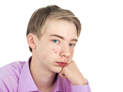 acne juvenile causes
